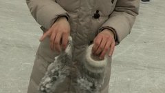 Загрубевшая от мороза кожа рук