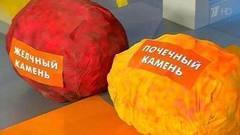 Почему в организме образуются камни. Жить здорово! Фрагмент выпуска от 14.09.2016