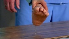 Что делать, если вы наступили на иглу. Жить здорово! Фрагмент выпуска от 17.02.2016