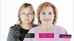На 10 лет моложе. Выпуск от 22.04.2017