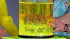 Сотрясение мозга у детей и взрослых. Жить здорово! Фрагмент выпуска от 07.06.2016