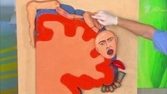 Микроинсульт. Как его отличить от инсульта? Жить здорово! Фрагмент выпуска от 05.02.2016