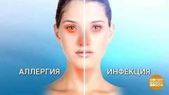 Аллергия на мороз. Доброе утро. Фрагмент выпуска от 10.01.2019